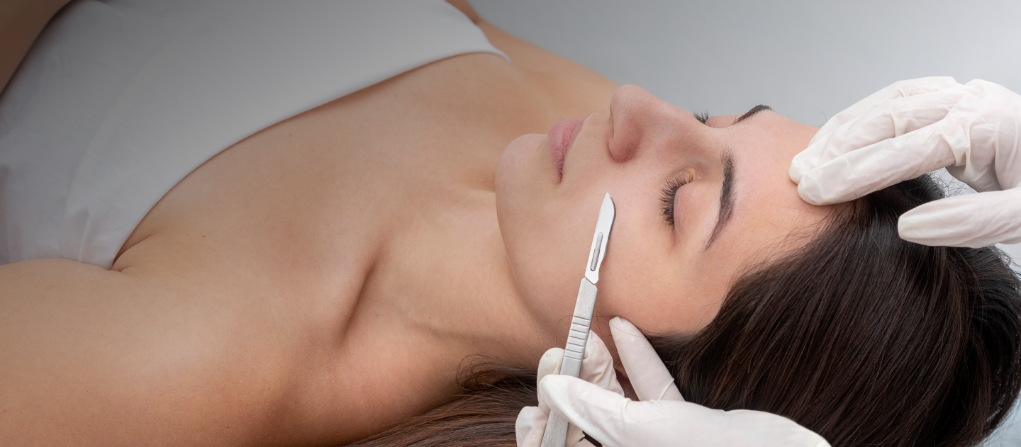 dermaplanning on face